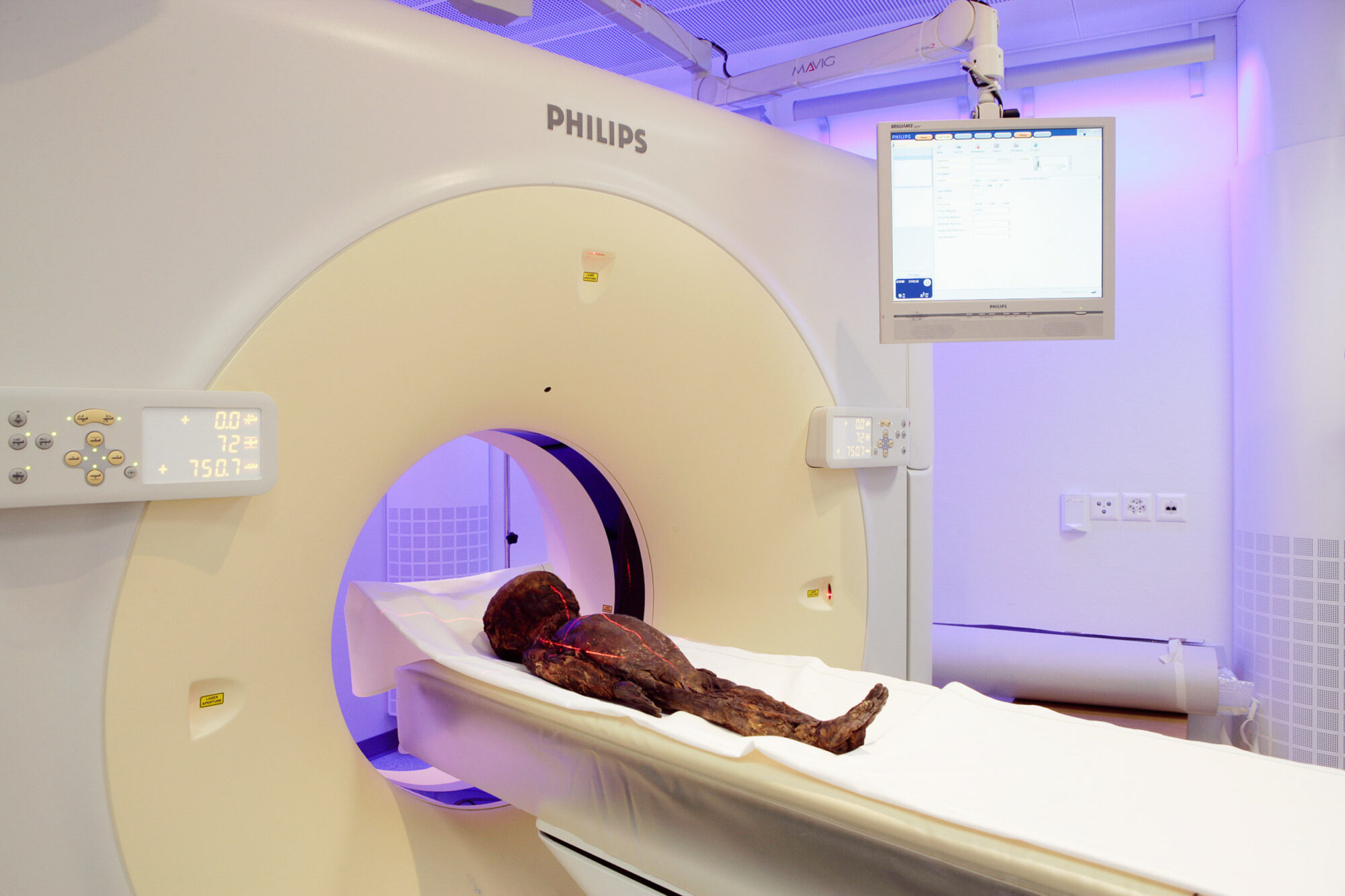 Zuerich, Schweiz, 6. Maerz 2008 - Die Altdorfer Kindermumie am UNI Spital Balgrist. Die Mumie im CT Untersuch.

Photo by Daniel Ammann