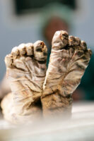 Zuerich, Schweiz, 6. Maerz 2008 - Die Altdorfer Kindermumie am UNI Spital Balgrist. Endoskopischer Untersuch im OP mit Dr. Hans Jutzi, Leiter der Intensivstation und Frank Ruehli mit dem Endoskop in der Hand.

Photo by Daniel Ammann