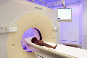 Zuerich, Schweiz, 6. Maerz 2008 - Die Altdorfer Kindermumie am UNI Spital Balgrist. Die Mumie im CT Untersuch.

Photo by Daniel Ammann