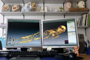 Zuerich, Schweiz,10. Maerz 2008 - Die CT Bilder werden im Computer am Institut von Frank Ruehli aufbereitet und mann kann virtuell durch den Koerper der Altdorfer Kindermumie reisen.

Photo by Daniel Ammann